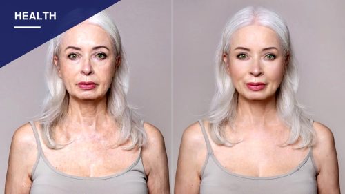 Plastic Surgeon Says There's a Right and Wrong Time to Get a Facelift