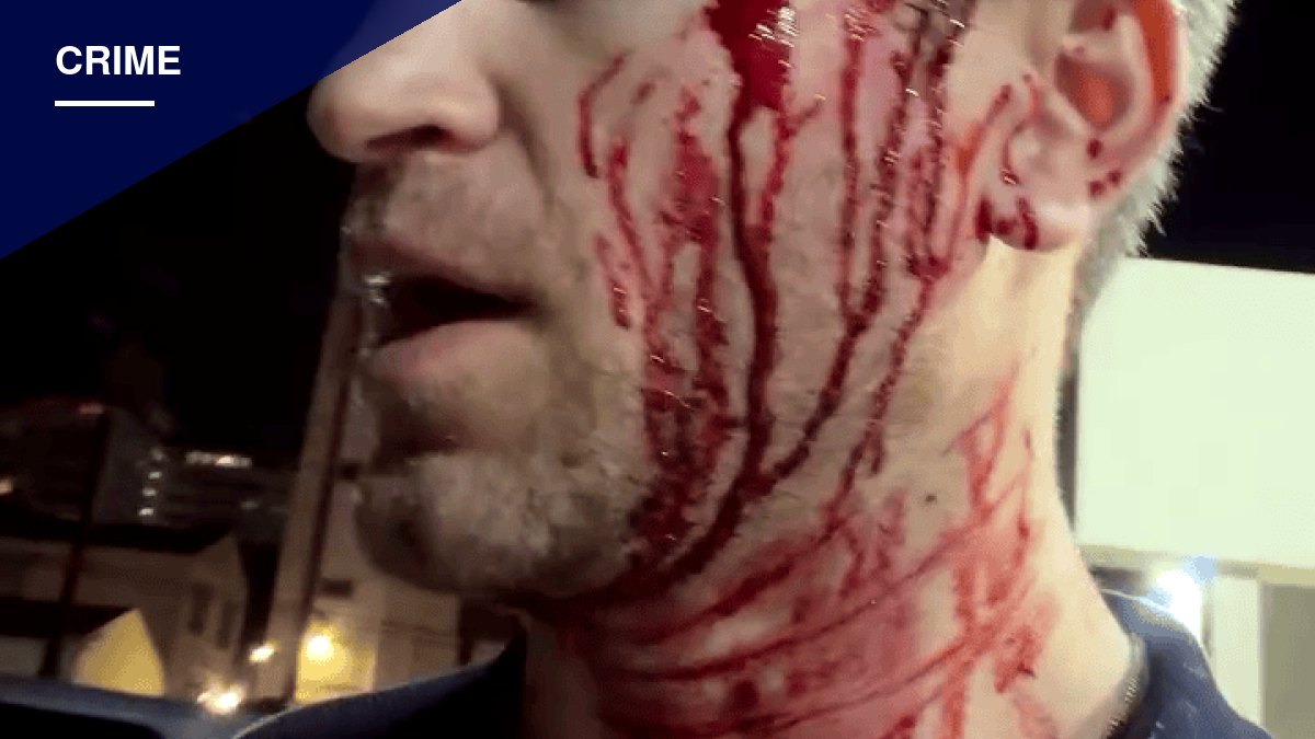 Actor Keegan Allen Robbed at Gunpoint Outside West Hollywood Grocery Store